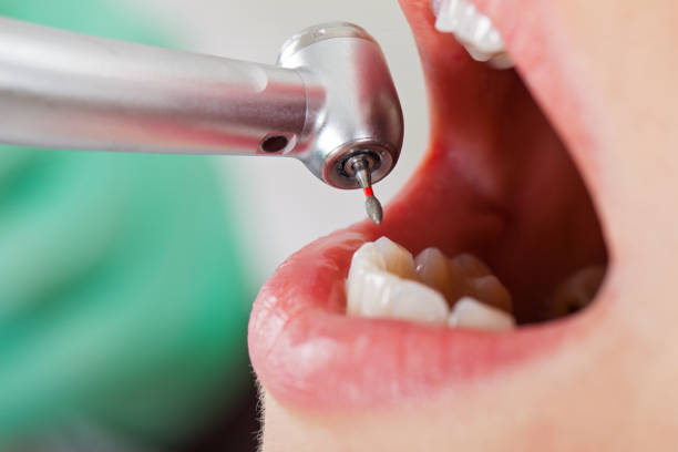 Urgent Tooth Repair in NM